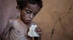 "الأونروا": طفلا من كل 10 أطفال في غزة يخضعون للفحص يعاني من سوء التغذية