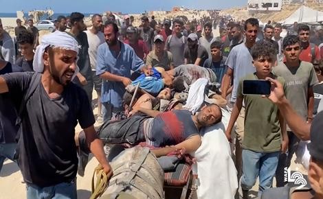 7 شهداء ومصابون في قصف الاحتلال منتظري المساعدات جنوب مدينة غزة