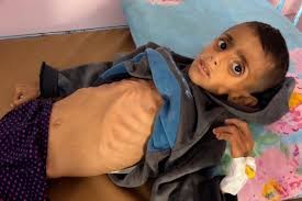 التبعات تستمر مدى الحياة