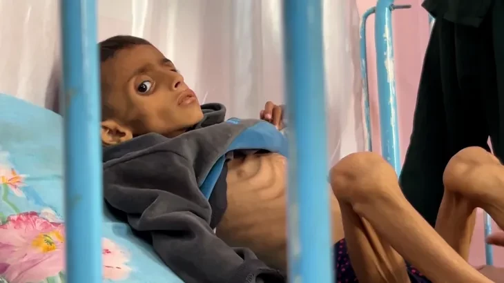 تقرير: غزة.. بطون خاوية وأجساد هزيلة تبحث عن الطعام واحتلال لا يستثني أحد