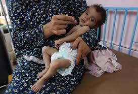 غزة تحتاج 250 ألف علبة حليب شهريا لإنقاذ الرُّضع من سوء التغذية