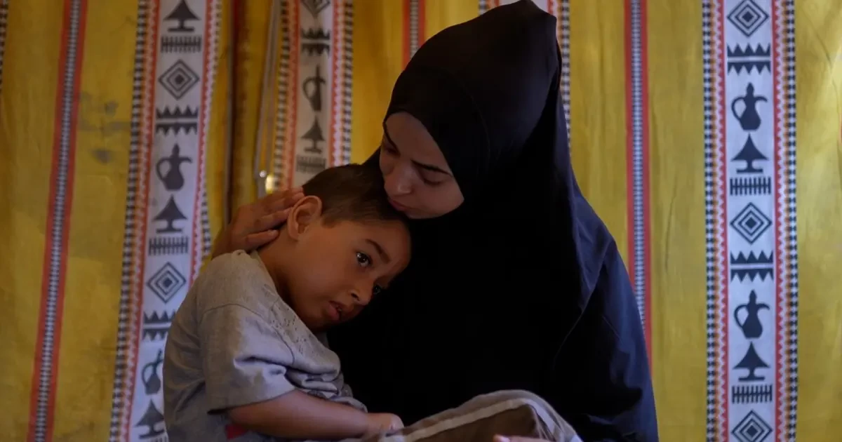 3 خلال ال 24 ساعة الماضية.. ارتفاع وفيات المجاعة في غزة إلى 162 شهيدا بينهم 92 طفلا