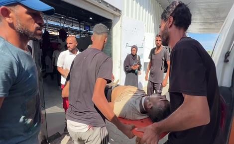 طبيب بريطاني: غزة تواجه همجية من العصور الوسطى