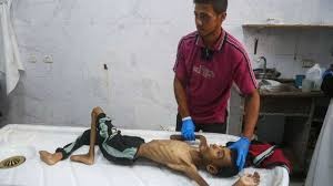 مصادر طبية تُحذر من تصاعد خطير في حالات الشلل الرخو الحاد بغزة