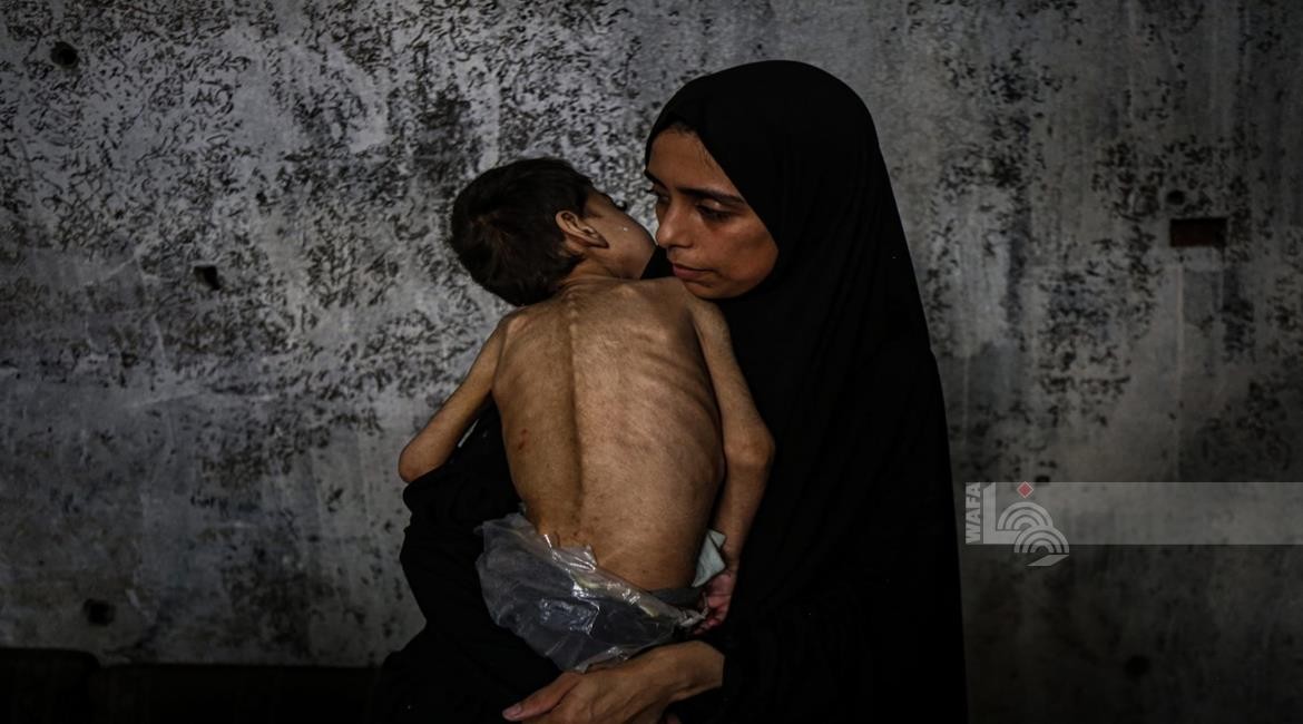 تصنيف دولي لانعدام الأمن الغذائي