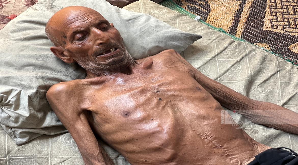 أوتشا: استمرار تفاقم التجويع وسوء التغذية بغزة