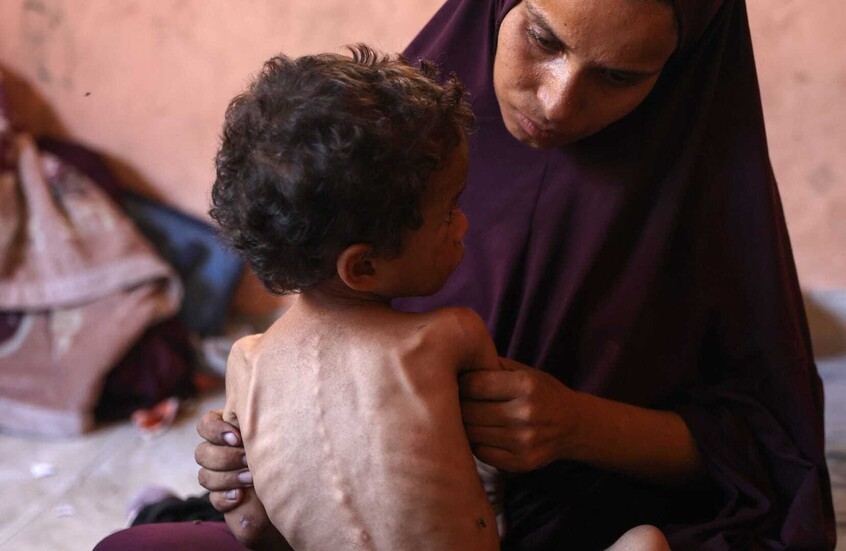 تتفشى بين الأطفال