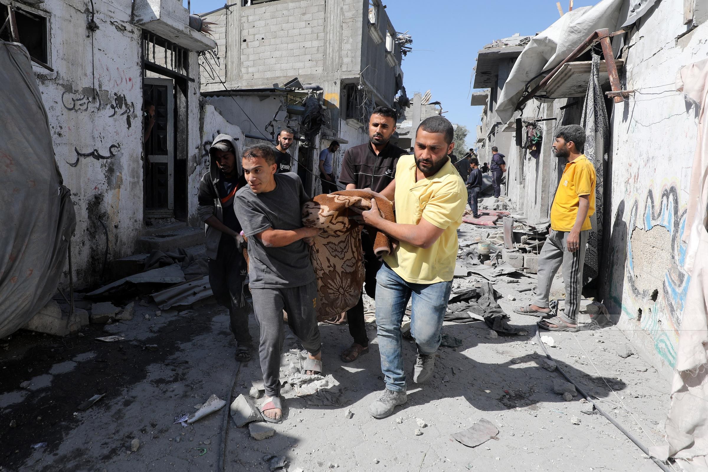 87 شهيدا و 409 إصابات جديدة خلال يوم في قطاع غزة