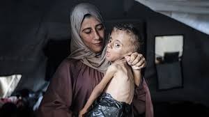 5 وفيات من بينهم 3 أطفال نتيجة المجاعة وسوء التغذية خلال الـ24 ساعة الماضية