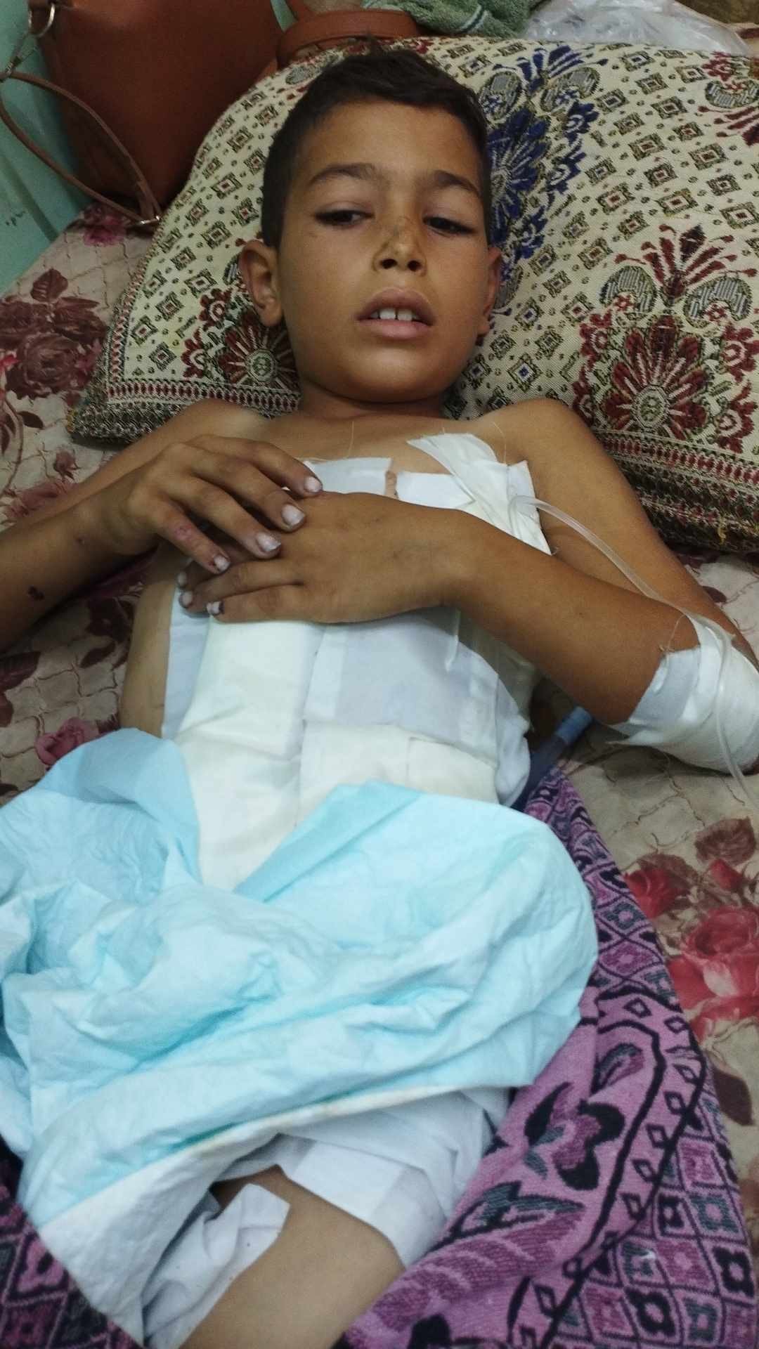 عائلة الطفل المصاب عبد الكريم السري تُناشد بسرعة إجلاء طفلها للعلاج في الخارج