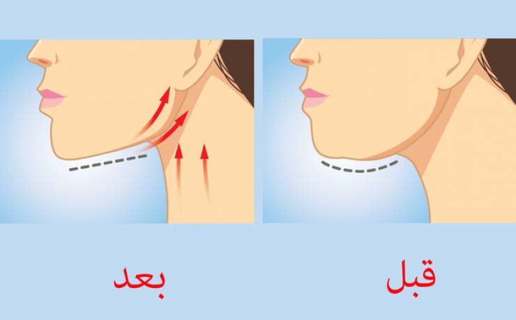 تخلص من الذقن المزدوج بهذه المادة السحرية الفعالة!