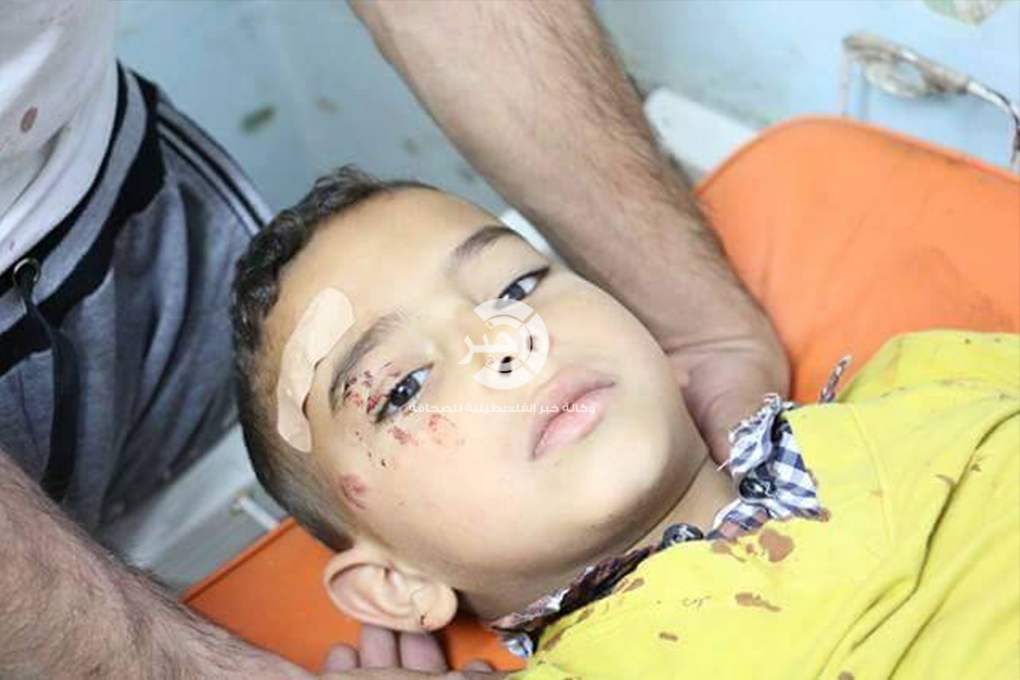 محدث .. بالصور: إصابة ثلاثة مواطنين جراء انهيار سقف منزلهم في خانيونس