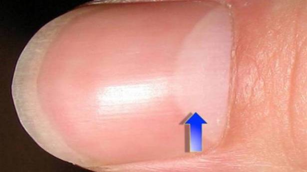 ماذا يعني وجود نصف قمر صغير على أظافركم؟!