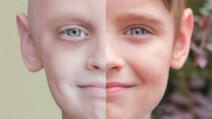 مفاجأة ..صلاة الفجر تقي من السرطان .. تعرف عليها !!