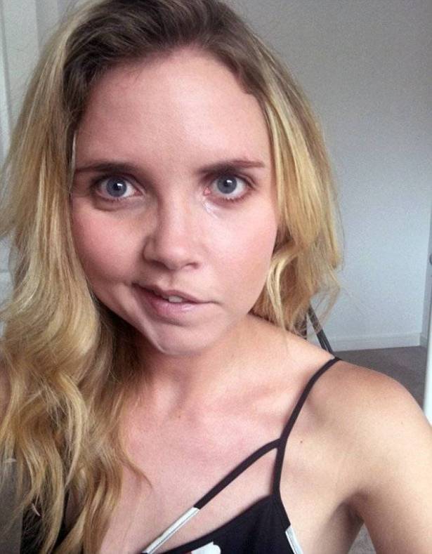 احذروا شاهدوا: استيقظت من نومها لتجد نصف وجهها مشلولاً.. والسبب!