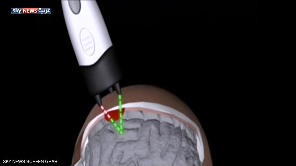 ماسحات ضوئية جديدة.. لإنقاذ أرواح الملاكمين