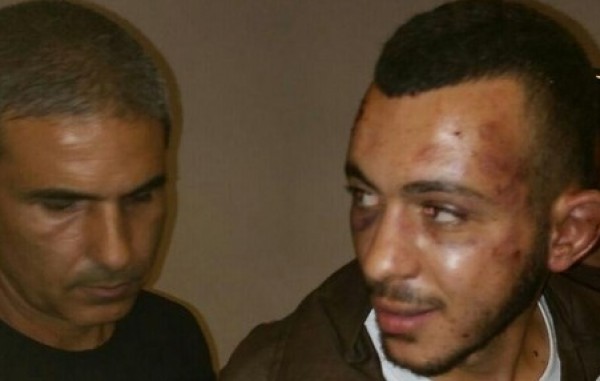 رغم آثار التعذيب .. علاء زيود يؤكد فبركة عملية الطعن بالخضيرة "حادث سير عادي"