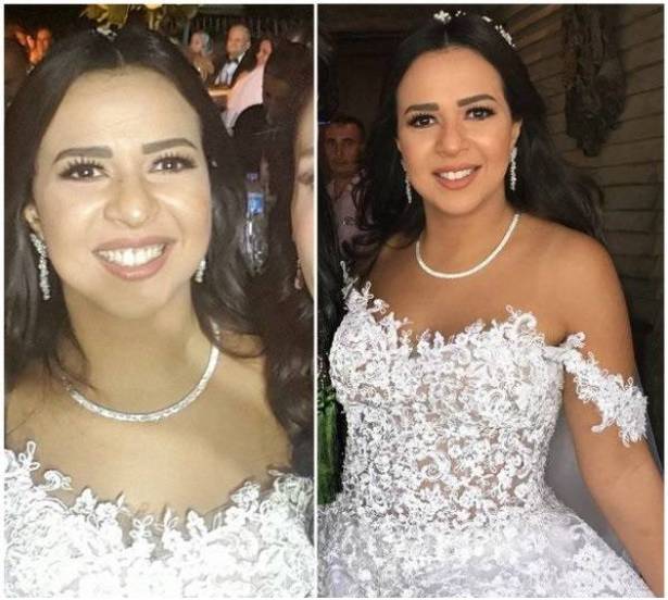 بعد ان ضجّت المواقع بزفافها ..شاهدوا صور ايمي سمير غانم بدون مكياج