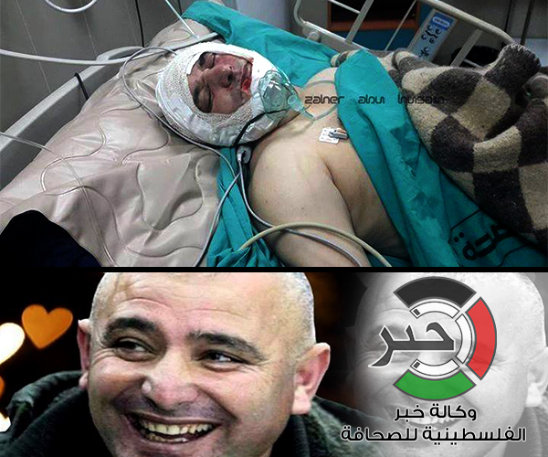 بالصور : اعتداء بآلة حادة بقصد القتل على منير الجاغوب والسلطة تعتقل المتورطين