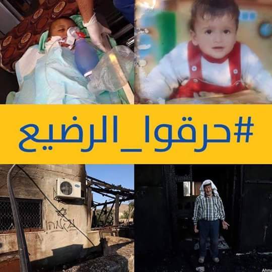 إدانة عربية ودولية بعد حرق الرضيع فلسطيني "علي"