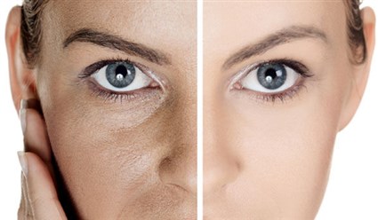 خلطات لتضييق وتنظيف  المسام الواسعة