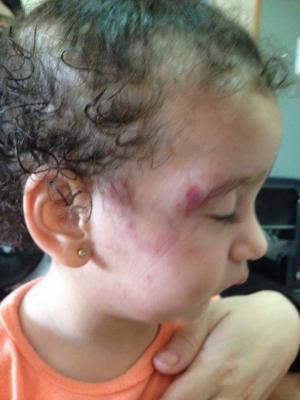 بالصور : قضية الرضيعة شام علاونة .. الفحص الطبي سيكشف من يقف وراء الاعتداء