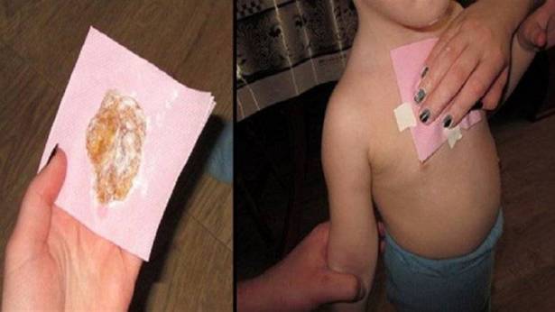 وصفة سحرية للتخلّص من السعال فوراً