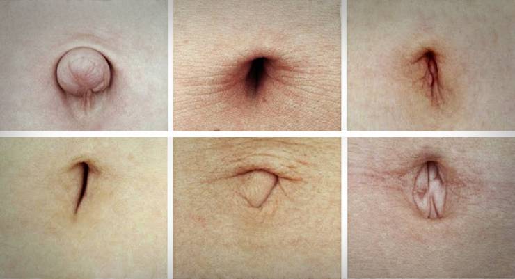 هل شكل سرتكم تشبه إحدى هذه الصور؟.. إذن عليكم قراءة الخبر!