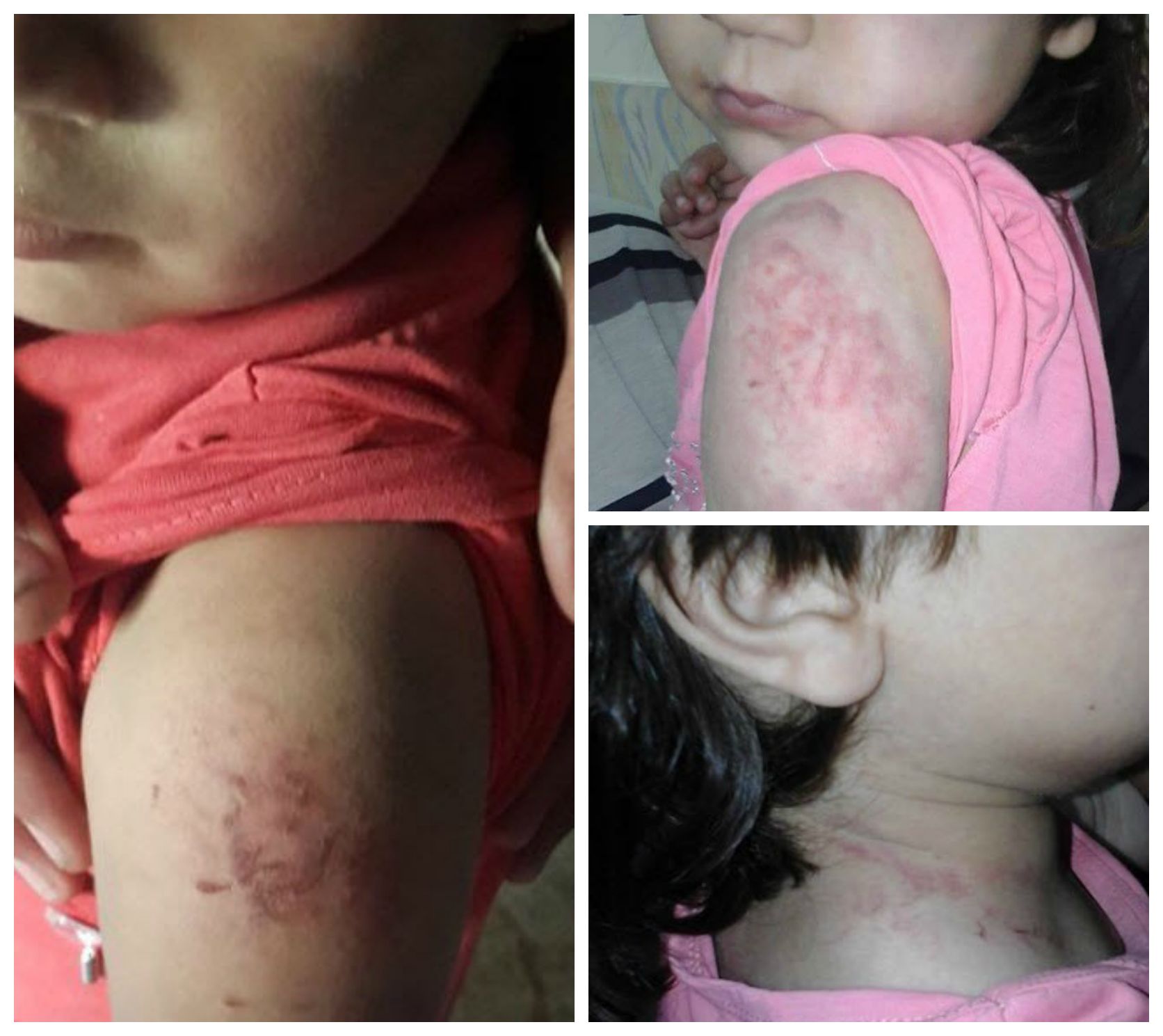 بالصور : تفاصيل حادثة اغتصاب طفلة "أربع أعوام" ومحاولة قتلها والشرطة تلقى القبض على الجاني في غزة