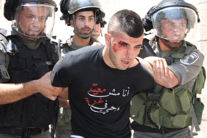 النحشون تعتدي على أسير بعد خضوعه لعملية جراحية !!