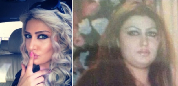 بالصور : نجمات الدراما السورية قبل عمليات التجميل... ستصدمكن أشكالهن