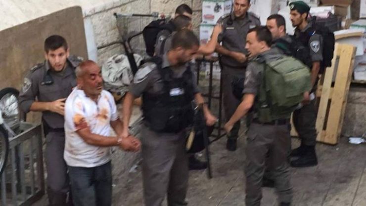 بالصور : عملية طعن في القدس