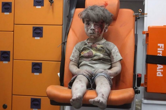 وفاة شقيق الطفل السوري عمران متأثراً بجراحه