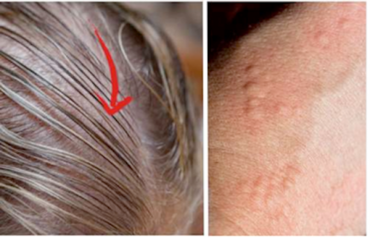 إذا لاحظت هذه الأعراض لديك فأنت تعاني من..