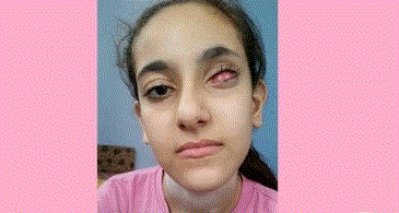 بالصور.. الرئيس يستجيب لمناشدة الطفلة أناغيم