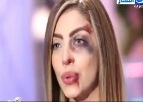بالفيديو.. مذيعة تظهر على الهواء وآثار الضرب تغطي وجهها