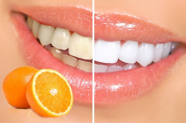 للحصول على ابتسامة النجمات