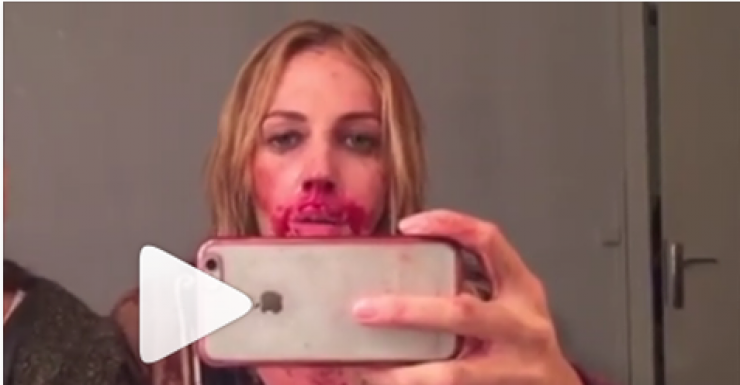 بالفيديو :  ميريام اوزرلي مضرجة بالدماء!!