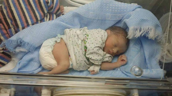 سوريا : شظية تخترق بطن حامل والجنين حي بحمص