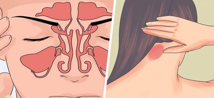 اكتشفوا عوارض السكري المبكرة التي يجهلها أغلب الأطباء...