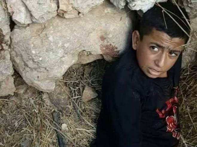 الأسير الطفل أسامة زيدات يُجري عملية جراحية حرجة