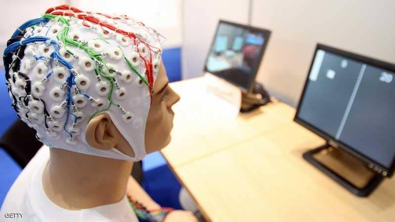 اكتشاف خلية "فريدة" بالمخ تميز الإنسان عن باقي الكائنات