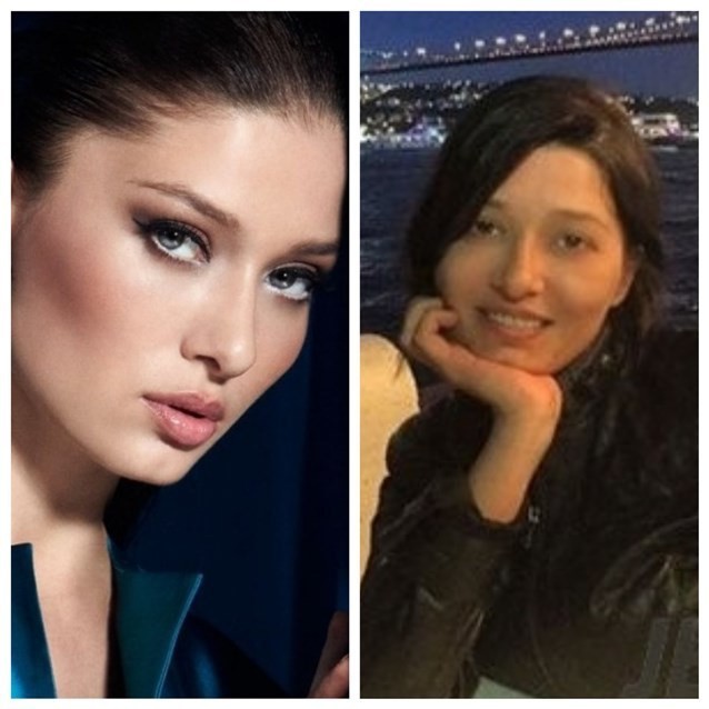 بالصور : تعرّفي على نجمات تركيا قبل العمليات التجميلية!