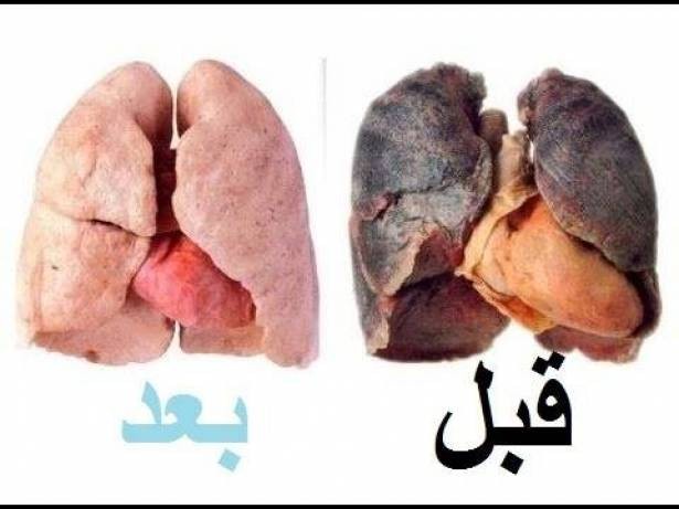 بالفيديو : تنظيف الرئة من النيكوتين خلال 72 ساعة بطريقة جديدة وبسيطة لن تتوقعها!