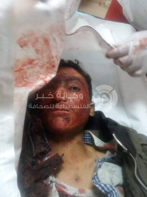 كيف جر جنود الاحتلال ولدًا في الثامنة لأكثر من ساعة في الخليل؟
