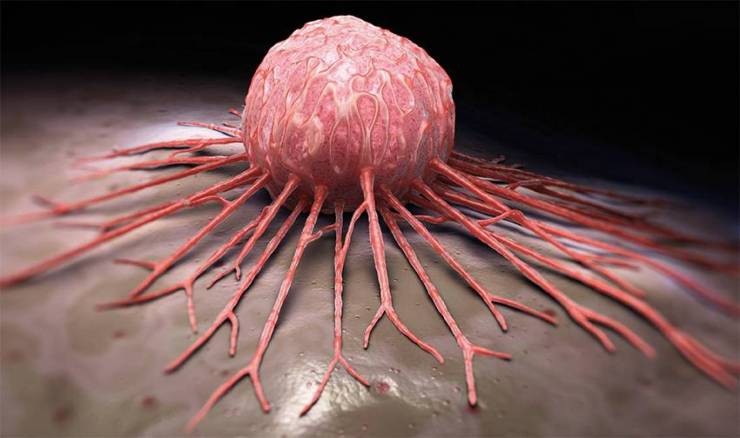 كبسولة قابلة للإبتلاع تكشف عن هذا النوع من السرطان