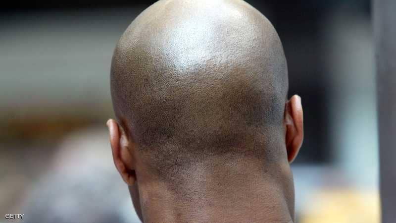 "حبة في اليوم" تقضي على الصلع والشيب