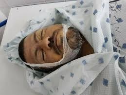 أصيب في الجمعة الأولى