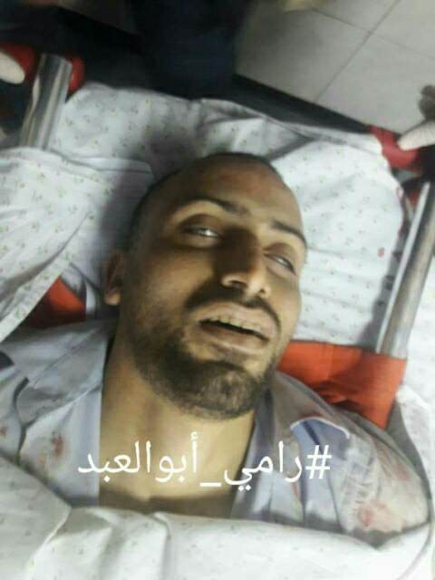  شهيدان وعشرات الإصابات في مواجهات جمعة الغضب على حدود القطاع