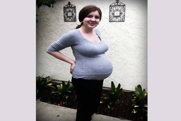 ضغط الأطباء على بطن الأم فكسروا عظام الجنين..هذا ما حدث بعد 6 أسابيع